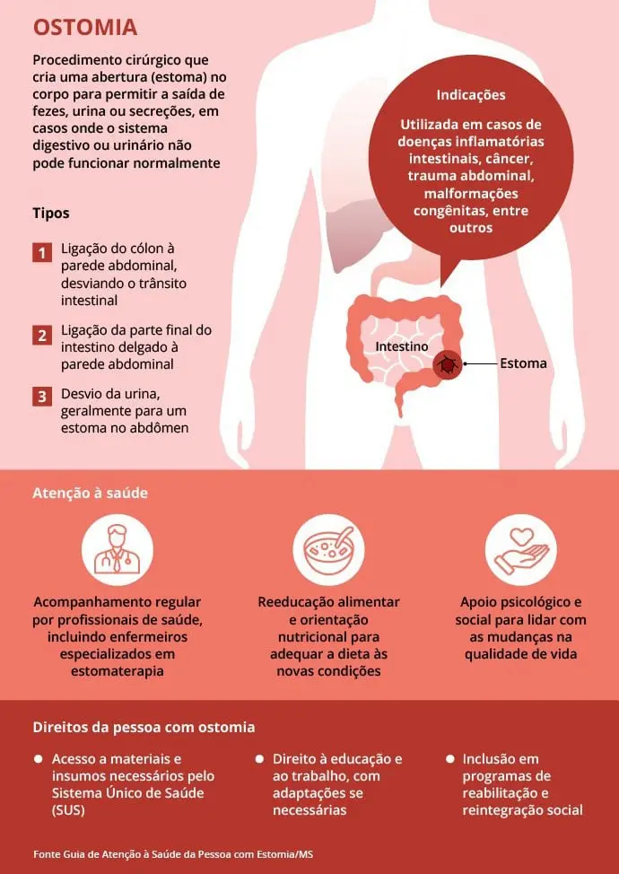 Associacao dos ostomizados de leme